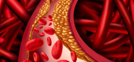 cwc vascular care
