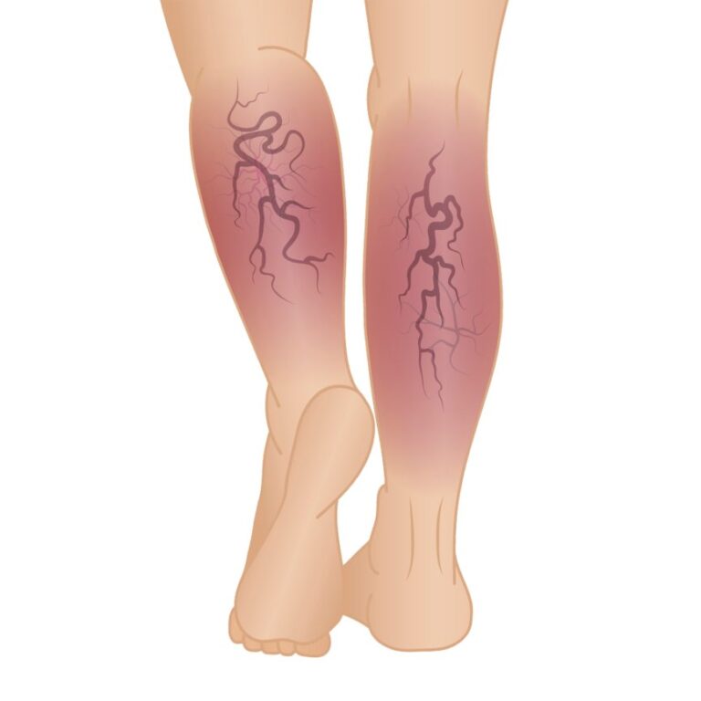 cwc vascular care